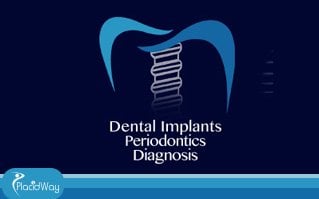 Slider image (1) Dental Implants Periodontics Diagnosis